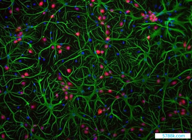 《当然》：刷新流露！科学家初次发现，星形胶质细胞尽然也有免疫牵挂，受到表不雅遗传调控